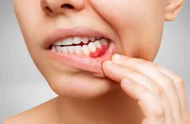 How Long Until a Tooth Infection Kills You?